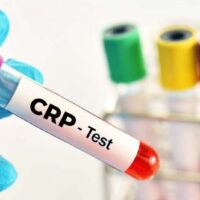 Crp C-Reaktif Protein Testi