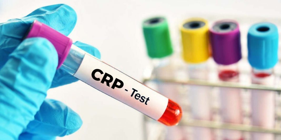 Crp C-Reaktif Protein Testi Crp C-Reaktif Protein Testi