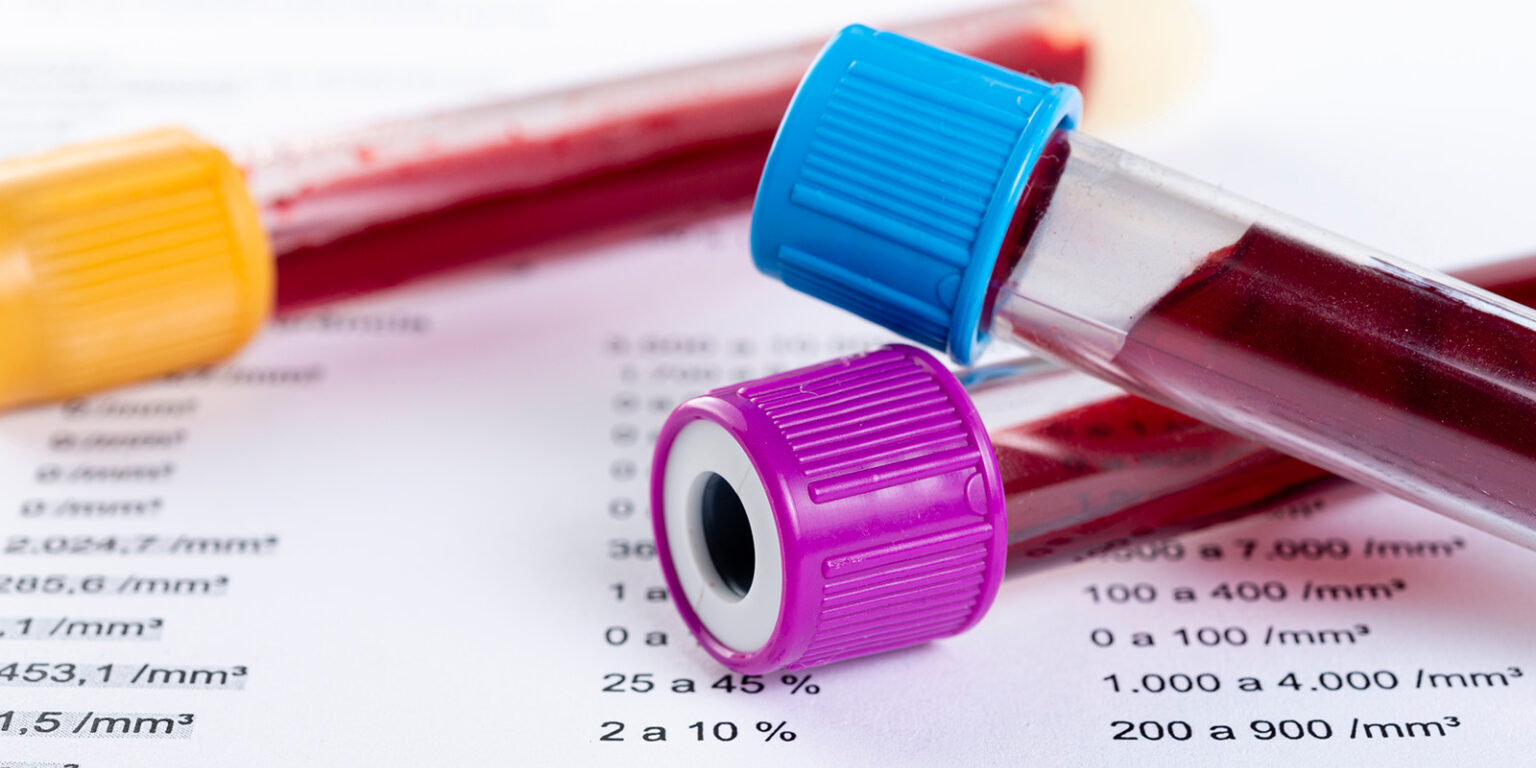 Tam Kan Sayımı ve Hemogram Tam Kan Sayımı ve Hemogram