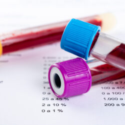 Tam Kan Sayımı ve Hemogram Tam Kan Sayımı ve Hemogram